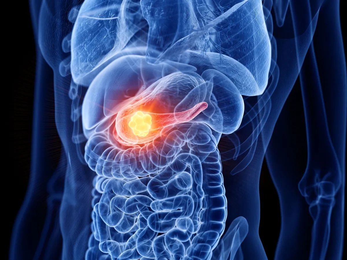 Tratamento experimental reduz risco de morte e anima especialistas em oncologia